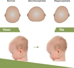 Novalits - Orthopedisch Baby Zijslaapkussen Met Traagschuim En Anti-Allergene Bamboe Microvezel Stof Om Een Plat Hoofd Tegen Te Gaan - Zijligkussen Voor Peuter - Babykussen Zijligging - Rolkussen - Steunkussen - Slaapondersteuning -Baby Peuter Winkel 1200x1103 2