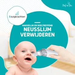 Hoy En Dia Neusreiniger Baby Snoetenpoetsers – Elektrische Neuszuiger En Blackhead Remover- Neuspeer Met USB - Muziek -Baby Peuter Winkel 1200x1200 371